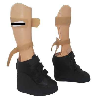 Modello Anatomico Malformazioni Di Piede 3B Scientific - VR4185L, Per Studio E Formazione Medica - Foto 5